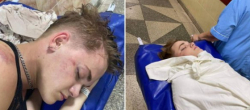 Статья. Жорстоке побиття танцівника-гея у Києві через нетрадиційну орієнтацію, УДО